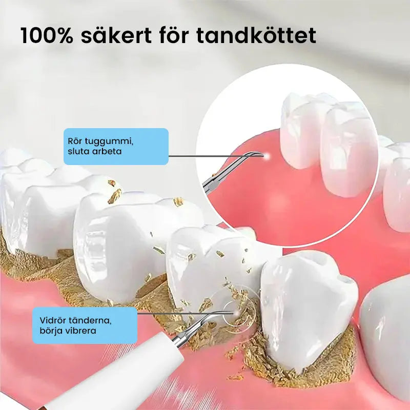 Ultraljud tandrengörare - Lamora Sverige