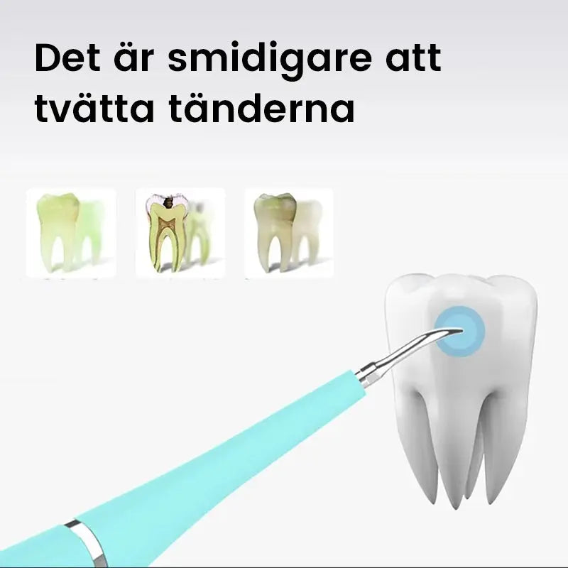 Ultraljud tandrengörare - Lamora Sverige